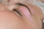 Vanish Aesthetic Laser Studio | Laser Hair Removal Service