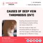 Best Doctor for DVT Treatment in Delhi | Dr. Tapish sahu