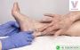 Varicose Veins Treatment in Hyderabad | Dr. Rahul Agarwal