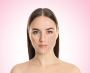Best Acne Scar Treatment in Chennai