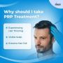 Prp Hair Treatment
