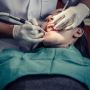 Expert Root Canal Treatment in Vernon, BC