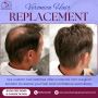 Non-Surgical Hair Replacement & Baldness Solutions in Delhi