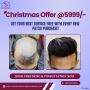 Non-Surgical hair wigs fixing in Rajouri Gardan | Best Hair 
