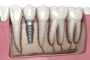 Top Dentists in Padi, Chennai