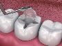 The Best Dental Care in Anna Nagar, Chennai