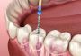 Best Dental Clinics in Kolathur, Chennai – Vijaya Dental Car