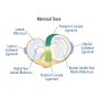 Discover the Most Trusted Surgeon for Meniscus Tear Surgery