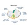 Professional Meniscus Repair Surgery for Effective Pain