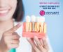Dental Implant Cost in Hyderabad | Dr.Anitha - Vistadent