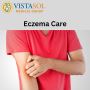 Eczema Care: Expert Tips & Relief