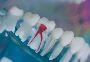 5 Key points of root canal treatment singapore 