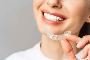5 Reasons Why Invisalign Is the Best Choice in Singapore