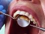 Easy Ways to Prepare for Your Tooth Extraction Day