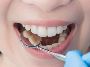 The Importance of Tooth Extractions in Oral Health