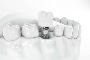 What Are the Benefits of Dental Implants?