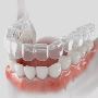5 Essential Tips for Clear Retainer Care