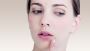 Expert Wart and Mole Removal in Chennai | Safe and Effective