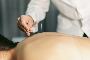 Acupuncture Treatment in Eastleigh – Wellspring Chinese Mass