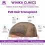 Best FUE hair transplant Treatment