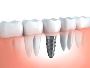 Leading Emergency Dentist St Ives | With Care Dental Leading Emergency Dentist St Ives | With Care Dental