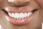 Get Your Best Smile with Porcelain Veneers Lindfield