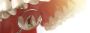 How to Reverse Tooth Decay? - Woodleigh waters dental surger