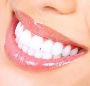 Teeth Whitening treatment in Berwick - Woodleigh Waters Dent