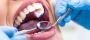 Top Benefits of Advanced Dental Implants for Oral Health