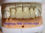 Chinese Dental Lab-Denture 