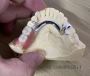 MYY Dental Laboratory Co.,Ltd | FDA Certified China Dental