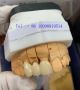 China Dental Lab Quick Turnaround Group | Top-Rated Chinese 