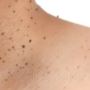 Book Expert Skin Treatment MK - Restore Your Skin Today!