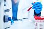 Get a Fast and Precise Hematology Test in Dubai