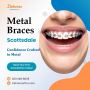 Metal Braces Scottsdale