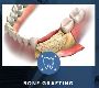 Zircteeth Of NH